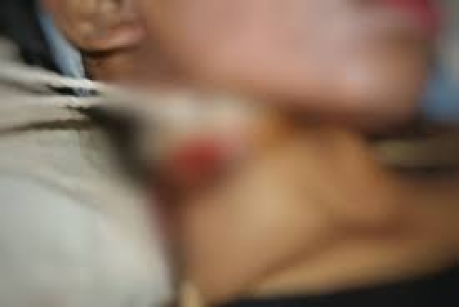 Polisia rejista kazu tara an 13 iha fulan haat ikus