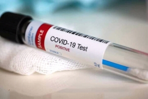 Teste PCR hatudu rejultadu positivu Covid-19. Foto:Dok.
